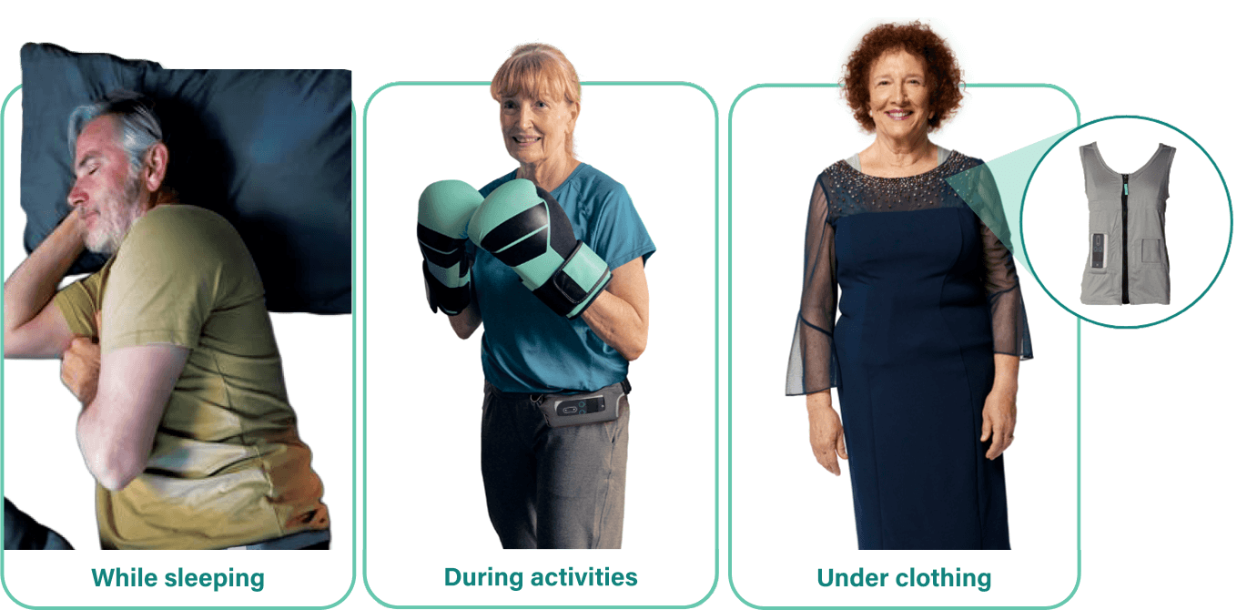 VYALEV® (foscarbidopa/foslevodopa) and its accessories can be worn under clothing.